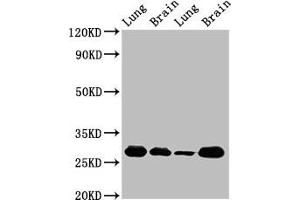 Western Blot Positive WB detected in: Rat lung tissue, Rat brain tissue, Mouse lung tissue, Mouse brain tissue All lanes: SFN antibody at 5 μg/mL Secondary Goat polyclonal to rabbit IgG at 1/50000 dilution Predicted band size: 28, 25 kDa Observed band size: 28 kDa (14-3-3 sigma/SFN anticorps  (AA 1-248))