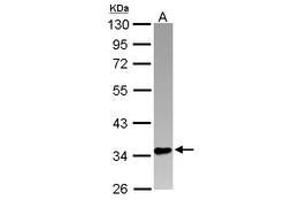 Image no. 1 for anti-PIN2/TERF1 Interacting, Telomerase Inhibitor 1 (PINX1) (AA 1-221) antibody (ABIN1500224) (PINX1 anticorps  (AA 1-221))