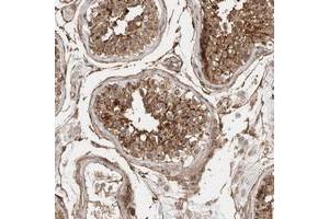 Immunohistochemical staining of human testis with LOC388333 polyclonal antibody  shows moderate cytoplasmic positivity in cells in seminiferus duct cells at 1:10-1:20 dilution. (SPDYE4 anticorps)