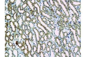 anti-Plau/Urokinase antibody