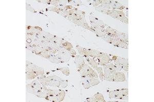 Immunohistochemistry of paraffin-embedded mouse heart using KDM4A antibody (ABIN5975678) at dilution of 1/100 (40x lens). (KDM4A anticorps)