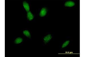 Immunofluorescence of purified MaxPab antibody to MAP2K4 on HeLa cell. (MAP2K4 anticorps  (AA 1-399))