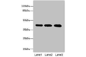 Western blot All lanes: RRAGC antibody at 1. (GTR2 anticorps  (AA 1-250))