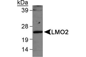 Western blot analysis of LMO2 in Ramos whole cell lysate using LMO2 polyclonal antibody . (LMO2 anticorps  (AA 1-100))