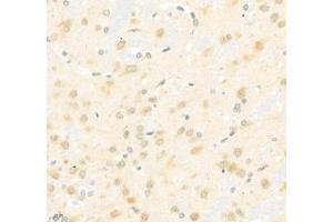 Immunohistochemistry of paraffin embedded rat brain using Arhgap17 (ABIN7075416) at dilution of 1: 700 (400x lens) (ARHGAP17 anticorps)