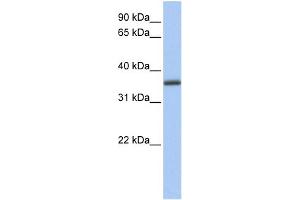 WB Suggested Anti-GALE Antibody Titration: 0. (GALE anticorps  (N-Term))