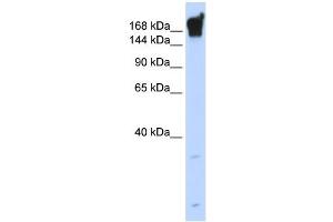 DYSF antibody used at 1 ug/ml to detect target protein. (Dysferlin anticorps)