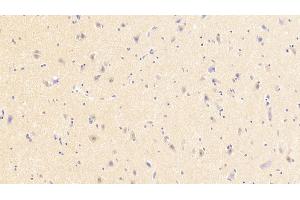 Detection of NMU in Human Cerebrum Tissue using Polyclonal Antibody to Neuromedin U (NMU)