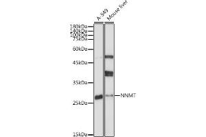 Immunohistochemistry of paraffin-embedded human liver using [KO Validated] NNMT Rabbit pAb (ABIN7268908) at dilution of 1:100 (40x lens).