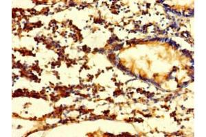 Immunohistochemistry of paraffin-embedded human appendix tissue using ABIN7152778 at dilution of 1:100 (FGF13 anticorps  (AA 1-245))