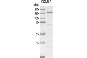 Recombinant UTX / KDM6A protein gel.