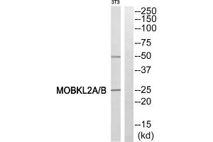 Western blot analysis of extracts from 3T3 cells, using MOBKL2A/B antibody. (MOBKL2A,B (N-Term) anticorps)