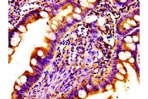 Immunohistochemistry of paraffin-embedded human small intestine tissue using ABIN7161709 at dilution of 1:100 (Norrie Disease (Pseudoglioma) anticorps  (AA 25-133))