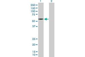Western Blot analysis of SLC1A2 expression in transfected 293T cell line by SLC1A2 MaxPab polyclonal antibody.