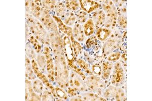 Immunohistochemistry of paraffin-embedded mouse kidney using GPS1 Rabbit pAb (ABIN6127934, ABIN6141361, ABIN6141362 and ABIN6222653) at dilution of 1:250 (40x lens).