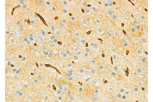 ABIN6265933 and ABIN6279507 at 1/100 staining Rat brain tissue by IHC-P.