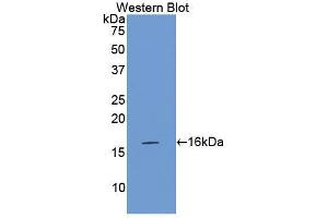 Western blot analysis of the recombinant protein. (Factor VII anticorps  (AA 315-433))