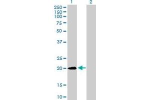 Western Blot analysis of SNX24 expression in transfected 293T cell line by SNX24 MaxPab polyclonal antibody. (SNX24 anticorps  (AA 1-169))