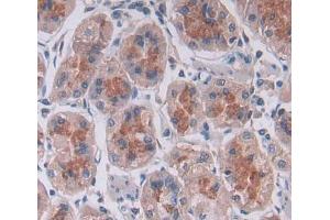Used in DAB staining on fromalin fixed paraffin- embedded stomach tissue (PTPN22 anticorps  (AA 1-233))