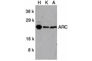 Western Blotting (WB) image for anti-ARC (C-Term) antibody (ABIN1030252) (ARC (C-Term) anticorps)
