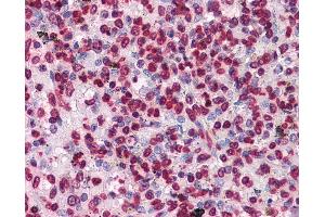 Anti-HIPK1 antibody IHC of human spleen. (HIPK1 anticorps  (AA 330-430))