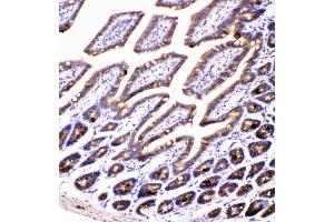 IHC analysis of AMFR using anti-AMFR antibody (ABIN4886455). (AMFR anticorps  (AA 553-643))