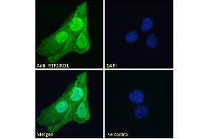 ABIN185681 Immunofluorescence analysis of paraformaldehyde fixed U2OS cells, permeabilized with 0.