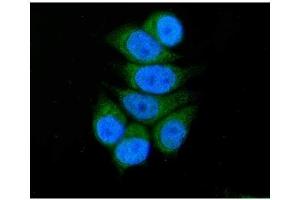 IF analysis of SBCAD/ACADSB using anti-SBCAD/ACADSB antibody (ABIN7602837). (ACADSB anticorps  (C-Term))