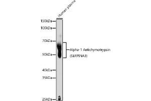 Western blot analysis of extracts of Human plasma, using Alpha-1 Antichymotrypsin (SERPIN) antibody (ABIN3016733, ABIN3016734, ABIN3016735 and ABIN6219829) at 1:1000 dilution.