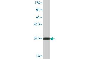 Western Blot detection against Immunogen (32. (CHFR anticorps  (AA 136-194))