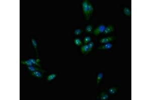 Immunofluorescent analysis of Hela cells using ABIN7159195 at dilution of 1:100 and Alexa Fluor 488-congugated AffiniPure Goat Anti-Rabbit IgG(H+L) (DMC1 anticorps  (AA 5-153))