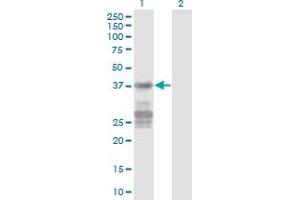 Western Blot analysis of CNN3 expression in transfected 293T cell line by CNN3 monoclonal antibody (M03), clone 2C7. (CNN3 anticorps  (AA 1-329))