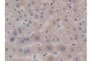 Detection of MAP2K6 in Human Liver Tissue using Polyclonal Antibody to Mitogen Activated Protein Kinase Kinase 6 (MAP2K6)