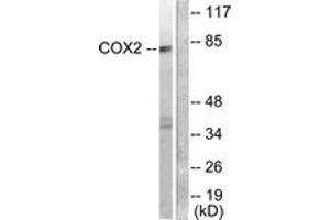 Western blot analysis of extracts from A549 cells, using Cox2 Antibody.