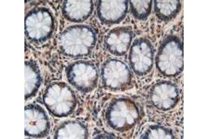 Figure. (LPCAT3 anticorps  (AA 122-233))