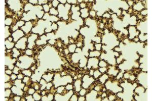 ABIN6273148 at 1/100 staining Mouse lung tissue by IHC-P.