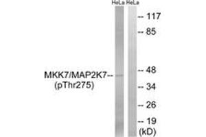Western blot analysis of extracts from HeLa cells treated with calyculinA 50ng/ml 30', using MAP2K7 (Phospho-Thr275) Antibody. (MAP2K7 anticorps  (pThr275))