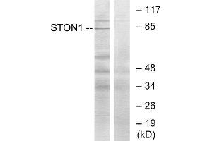 Western Blotting (WB) image for anti-Stonin 1 (STON1) (C-Term) antibody (ABIN1850138) (STON1 anticorps  (C-Term))