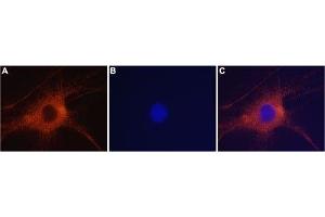 Expression of GluR6 in rat DRG neurons - Immunocytochemistry of rat dorsal root ganglion (DRG) neurons.