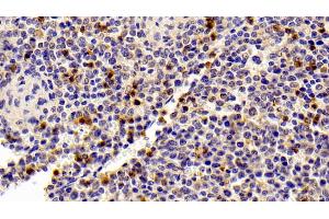 Detection of S100A8 in Porcine Spleen Tissue using Polyclonal Antibody to S100 Calcium Binding Protein A8 (S100A8)