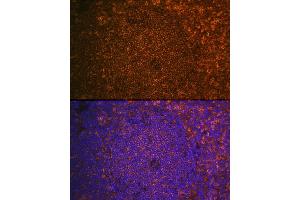 Immunofluorescence analysis of Mouse spleen using CST7 antibody (ABIN6131040, ABIN6139156, ABIN6139157 and ABIN6224188) at dilution of 1:100.