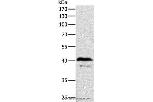 Western blot analysis of Mouse brain tissue, using ADAP1 Polyclonal Antibody at dilution of 1:500 (ADAP1 anticorps)