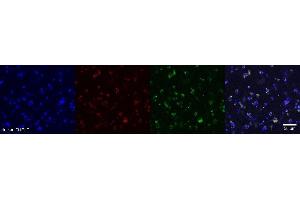 Immunohistochemistry (IHC) image for anti-Oligodendrocytic Myelin Paranodal and Inner Loop Protein (OPALIN) antibody (ABIN7456340) (OPALIN anticorps)