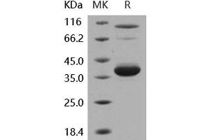 Western Blotting (WB) image for Interleukin 8 (IL8) (AA 28-99) protein (Fc Tag) (ABIN7317015) (IL-8 Protein (AA 28-99) (Fc Tag))