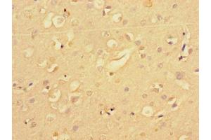Immunohistochemistry of paraffin-embedded human brain tissue using ABIN7159413 at dilution of 1:100
