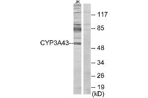 Western blot analysis of extracts from Jurkat cells, using Cytochrome P450 3A43 antibody. (CYP3A4 anticorps)