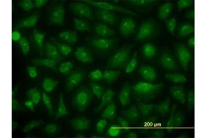 Immunofluorescence of monoclonal antibody to KIAA1967 on HeLa cell.