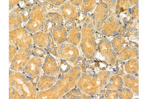 ABIN6263217 and ABIN6266832 at 1/100 staining Rat kidney tissue by IHC-P.