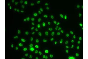 Immunofluorescence analysis of MCF-7 cells using PHIP antibody (ABIN5974339). (PHIP anticorps)