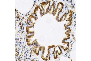 Immunohistochemistry of paraffin-embedded rat lung using HSP90AB1 Antibody.